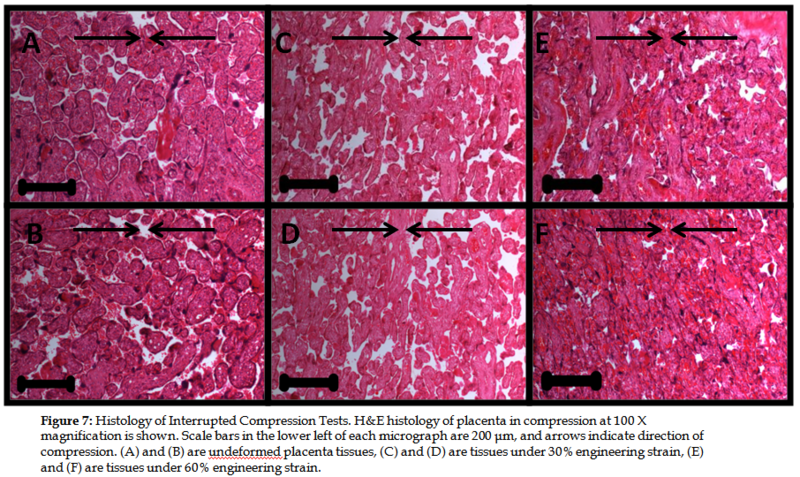 File:Placenta fig7.PNG