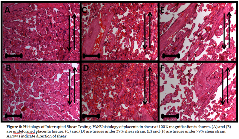 File:Placenta fig8.PNG