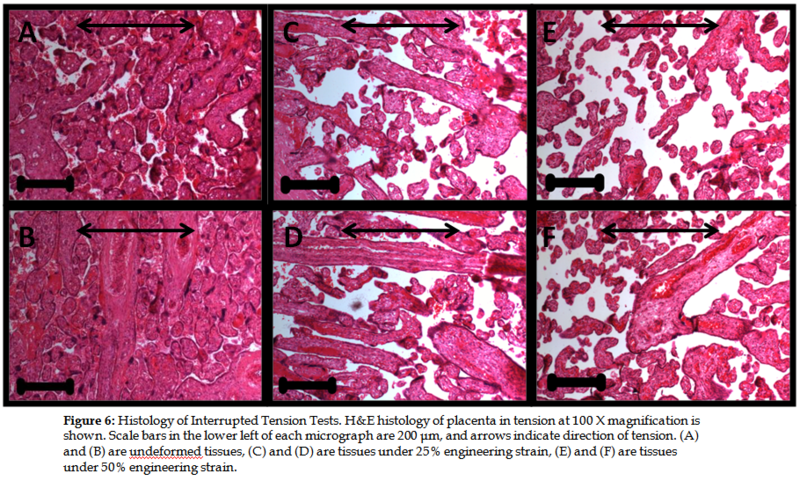 File:Placenta fig6.PNG