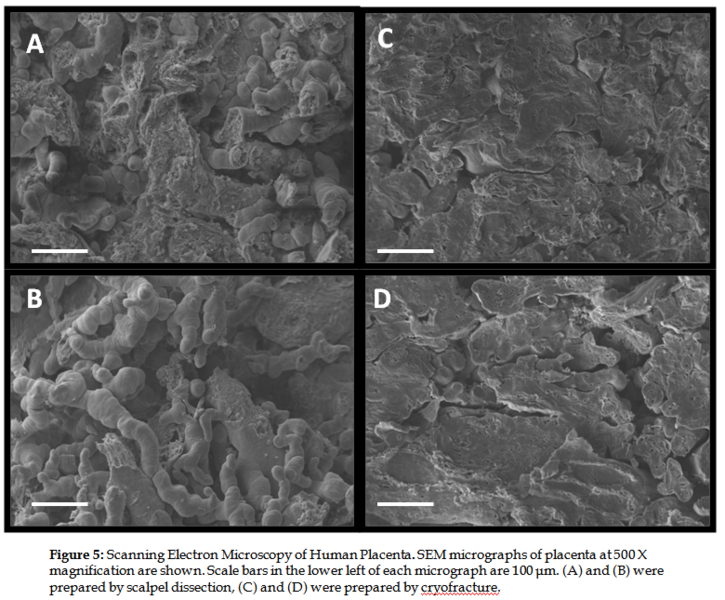 File:Placenta fig5.PNG